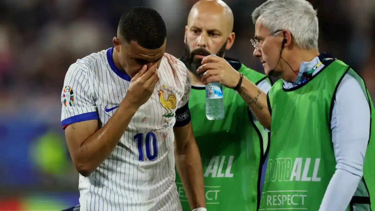 Kylian Mbappé fraturou o nariz na Euro 2024, mas seguirá jogando com máscara; participação contra a Holanda ainda é incerta.